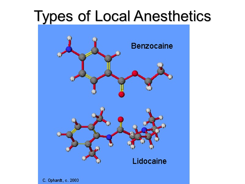 Types of Local Anesthetics Types of Local Anesthetics